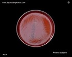proteus vulgaris swarming